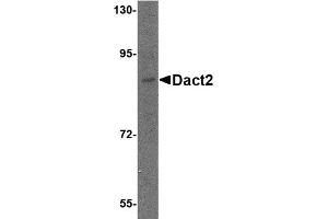 Western Blotting (WB) image for anti-Dapper, Antagonist of beta-Catenin 2 (DACT2) (N-Term) antibody (ABIN1031341) (DACT2 anticorps  (N-Term))