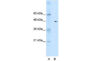 Western Blot showing GDI2 antibody used at a concentration of 1-2 ug/ml to detect its target protein. (GDI2 anticorps  (C-Term))