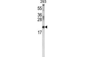 Western Blotting (WB) image for anti-Retinol Binding Protein 2, Cellular (RBP2) antibody (ABIN3004227) (RBP2 anticorps)