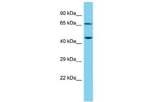 Host: Rabbit Target Name: CTTNBP2NL Sample Type: NCI-H226 Whole Cell lysates Antibody Dilution: 1. (CTTNBP2NL anticorps  (N-Term))