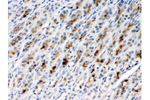 TCP1 beta was detected in paraffin-embedded sections of rat gaster tissues using rabbit anti- TCP1 beta Antigen Affinity purified polyclonal antibody (Catalog # ) at 1 µg/mL. (CCT2 anticorps  (AA 414-535))