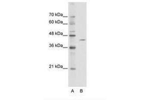 Image no. 1 for anti-Zinc Finger and BTB Domain Containing 26 (ZBTB26) (AA 181-230) antibody (ABIN6736113) (ZBTB26 anticorps  (AA 181-230))