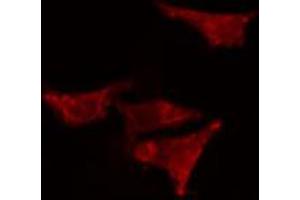 ABIN6266802 staining HeLa cells by IF/ICC. (EPS8-Like 2 anticorps  (N-Term))