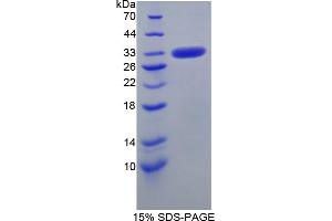 SDS-PAGE analysis of Human CA5B Protein.
