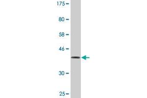 Western Blot detection against Immunogen (36. (DOCK4 anticorps  (AA 1867-1966))