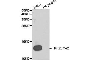 Western blot analysis of extracts of various cell lines, using Dimethyl-Histone H4-K20 antibody (ABIN5969818). (Histone H4 anticorps  (2meLys20))