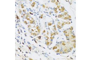 Immunohistochemistry of paraffin-embedded human stomach using RNASE3 antibody (ABIN5974969) at dilution of 1/100 (40x lens). (RNASE3 anticorps)