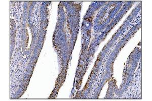 anti-C-Mer Proto-Oncogene Tyrosine Kinase (MERTK) (AA 21-489) antibody
