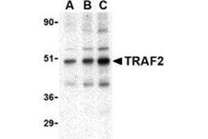 Western blot analysis of TRAF2 in mouse liver tissue lysate with this product at (A) 0. (TRAF2 anticorps  (C-Term))