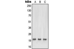 Western blot analysis of NRAS/HRAS/KRAS expression in HEK293T (A), HeLa (B), mouse brain (C), rat heart (D) whole cell lysates. (NRAS/HRAS/KRAS anticorps  (N-Term))