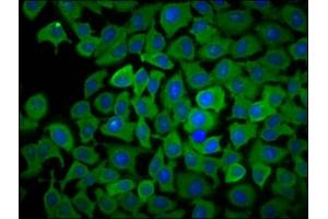 Immunofluorescence staining of A549 cells with ABIN7163387 at 1:166, counter-stained with DAPI.