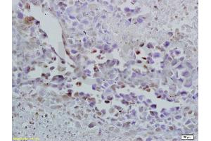 Formalin-fixed and paraffin embedded mouse lymphoma labeled with Anti-Oct-3/Oct-4 Polyclonal Antibody, Unconjugated (ABIN737826) at 1:200 followed by conjugation to the secondary antibody and DAB staining. (OCT4 anticorps  (AA 201-300))