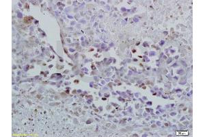 Formalin-fixed and paraffin embedded mouse lymphoma labeled with Anti-Oct-3/Oct-4 Polyclonal Antibody, Unconjugated (ABIN737826) at 1:200 followed by conjugation to the secondary antibody and DAB staining. (OCT4 anticorps  (AA 201-300))
