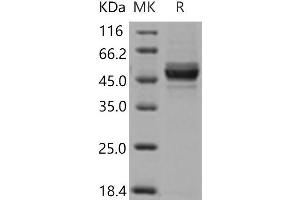 Western Blotting (WB) image for Glutamic Pyruvate Transaminase (Alanine Aminotransferase) 2 (GPT2) protein (His tag) (ABIN7321245)