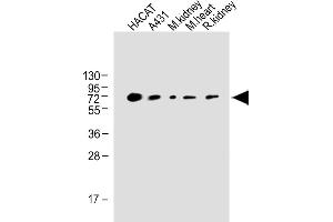 All lanes : Anti-OTOP1 Antibody (Center) at 1:1000 dilution Lane 1: HACAT whole cell lysate Lane 2: A431 whole tissue lysate Lane 3: Mouse kidney whole tissue lysate Lane 4: Mouse heart whole tissue lysate Lane 5: Rat kidney whole cell lysate Lane Lysates/proteins at 20 μg per lane. (Otopetrin 1 anticorps  (AA 360-388))
