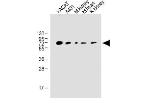 All lanes : Anti-OTOP1 Antibody (Center) at 1:1000 dilution Lane 1: HACAT whole cell lysate Lane 2: A431 whole tissue lysate Lane 3: Mouse kidney whole tissue lysate Lane 4: Mouse heart whole tissue lysate Lane 5: Rat kidney whole cell lysate Lane Lysates/proteins at 20 μg per lane.