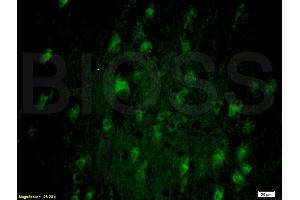 Formalin-fixed and paraffin-embedded rat brain labeled with Anti-SNAP25 Polyclonal Antibody, Unconjugated (ABIN738111) 1:200, overnight at 4°C, The secondary antibody was Goat Anti-Rabbit IgG, FiTC conjugated used at 1:200 dilution for 40 minutes at 37°C.