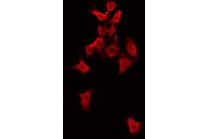 ABIN6274483 staining COLO205 by IF/ICC. (ALPK1 anticorps  (Internal Region))
