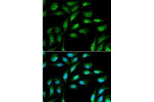 Immunofluorescence analysis of MCF-7 cells using B2M antibody. (beta-2 Microglobulin anticorps  (AA 21-119))