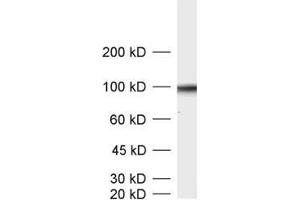 dilution: 1 : 1000, sample: crude synaptic vesicle fraction of rat brain (LP2) (SV2B anticorps  (AA 2-17))