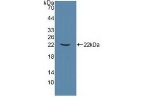 Detection of Recombinant ATP1a1, Human using Polyclonal Antibody to ATPase, Na+/K+ Transporting Alpha 1 Polypeptide (ATP1a1)