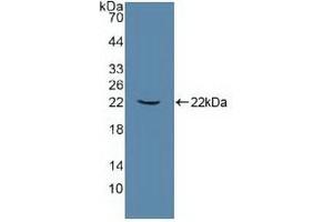 Detection of Recombinant ATP1a1, Human using Polyclonal Antibody to ATPase, Na+/K+ Transporting Alpha 1 Polypeptide (ATP1a1) (ATP1A1 anticorps  (AA 493-660))
