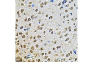 Immunohistochemistry of paraffin-embedded rat brain using PPID Antibody (ABIN5974177) at dilution of 1/100 (40x lens). (PPID anticorps)