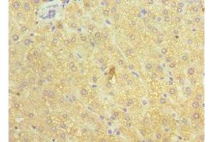 Immunohistochemistry of paraffin-embedded human liver tissue using ABIN7148555 at dilution of 1:100 (ATP7B anticorps  (AA 1166-1465))