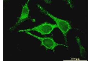 Immunofluorescence of monoclonal antibody to CLIC5 on HeLa cell.