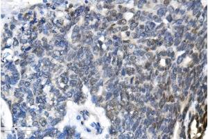 IHC analysis of METTL3 using anti-METTL3 antibody (ABIN7602808). (METTL3 anticorps  (C-Term))