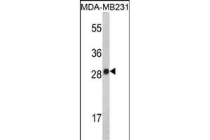 Western blot analysis of IL2 Antibody (Center) (ABIN390899 and ABIN2841106) in MDA-M cell line lysates (35 μg/lane). (IL-2 anticorps  (AA 50-77))