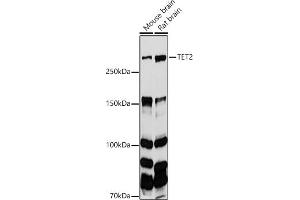 Western blot analysis of extracts of various cell lines, using TET2 antibody (ABIN6133019, ABIN6149017, ABIN6149019 and ABIN6221336) at 1:1000 dilution. (TET2 anticorps  (AA 1833-2002))