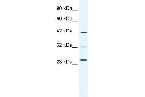 WB Suggested Anti-E2F1 Antibody Titration:  0.