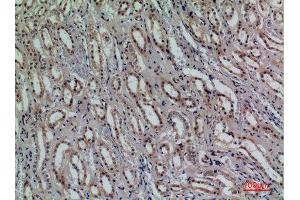 Immunohistochemistry (IHC) analysis of paraffin-embedded Human Kidney, antibody was diluted at 1:100. (CD159a/c (Internal Region) anticorps)