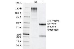 SDS-PAGE Analysis of Purified, BSA-Free TDP2 Antibody (clone TDP2/1258). (TDP2 anticorps)