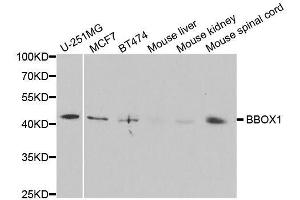 Western blot analysis of extracts of various cell lines, using BBOX1 antibody.