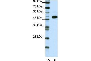 WB Suggested Anti-TADA3L Antibody Titration:  0. (TADA3L anticorps  (N-Term))