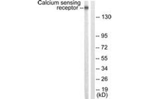 Western blot analysis of extracts from LOVO cells, using Calcium Sensing Receptor (Ab-888) Antibody. (CASR anticorps  (AA 854-903))