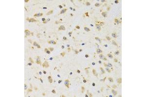 Immunohistochemistry of paraffin-embedded rat brain using RPS12 antibody (ABIN5973491) at dilution of 1/100 (40x lens). (RPS12 anticorps)