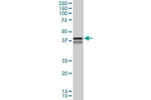 PCBP2 monoclonal antibody (M04), clone 3A1. (PCBP2 anticorps  (AA 1-362))