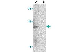 Western blot analysis of IL23A in Raji lysate with IL23A polyclonal antibody  at 1 ug/mL in the (A) absence and (B) presence of blocking peptide.