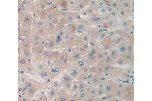 IHC-P analysis of Human Tissue, with DAB staining. (MPST anticorps  (AA 68-278))