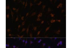 Immunofluorescence analysis of C6 cells using POR Polyclonal Antibody at dilution of 1:100 (40x lens). (POR anticorps)