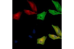 ABIN7095058 and ABIN7099114 staining  cells by IF/ICC.