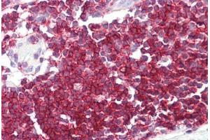 Image no. 2 for anti-Septin 9 (SEPT9) (C-Term) antibody (ABIN6749752)