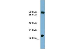 WB Suggested Anti-VPS53 Antibody Titration: 0. (VPS53 anticorps  (Middle Region))