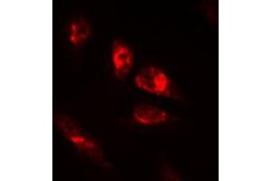 Immunofluorescent analysis of OCT2 staining in HeLa cells. (Oct-2 anticorps  (N-Term))