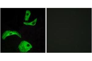 Immunofluorescence analysis of HeLa cells, using GPR18 Antibody. (GPR18 anticorps  (AA 131-180))