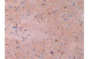 IHC-P analysis of Rat Spinal Cord Tissue, with DAB staining.