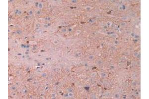 IHC-P analysis of Rat Spinal Cord Tissue, with DAB staining. (CAPNL1 anticorps  (AA 387-694))